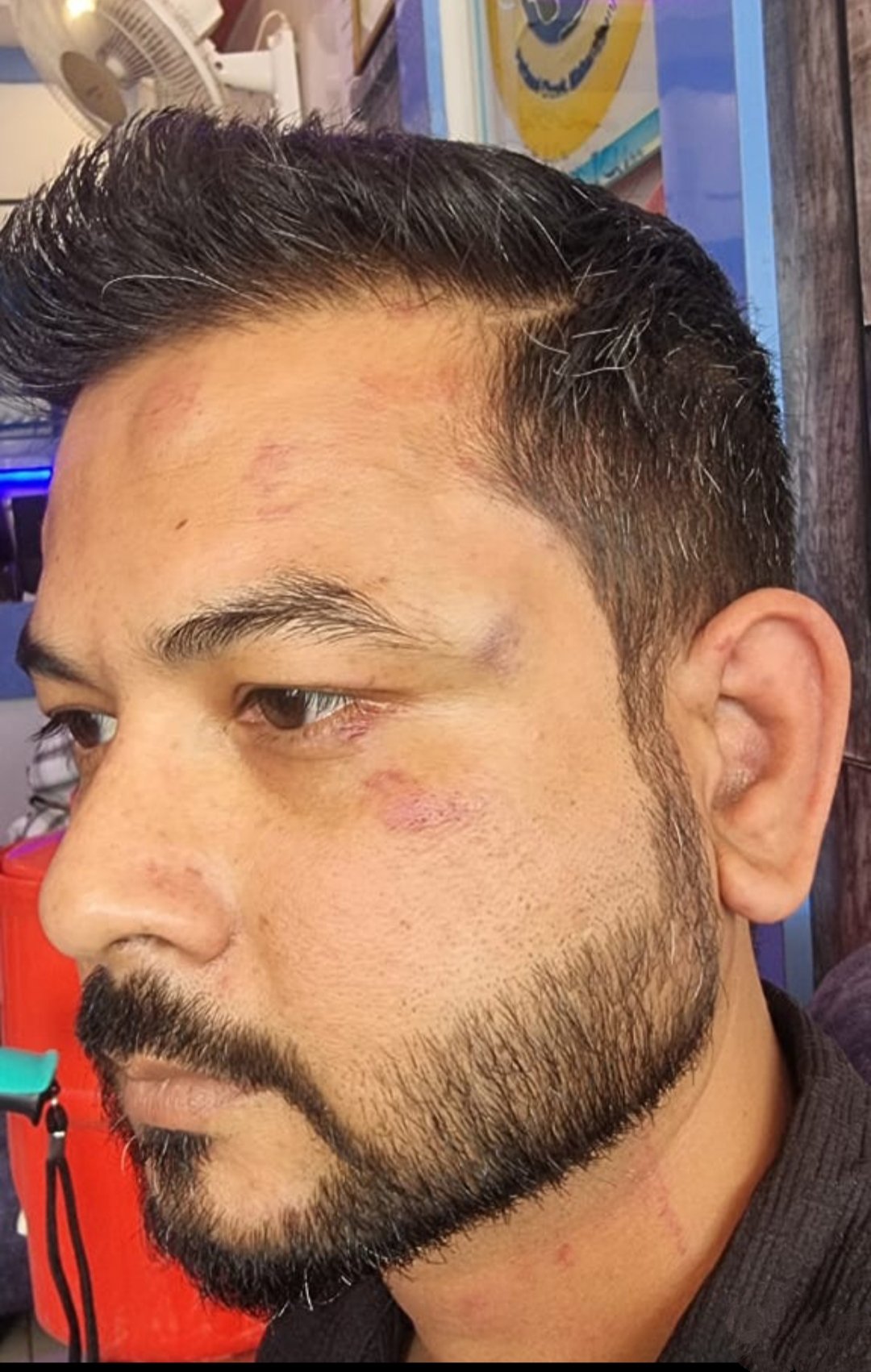 सभासद पर दुकानदार को पीटने व जान से मारने की धमकी का आरोप, पुलिस जांच में जुटी