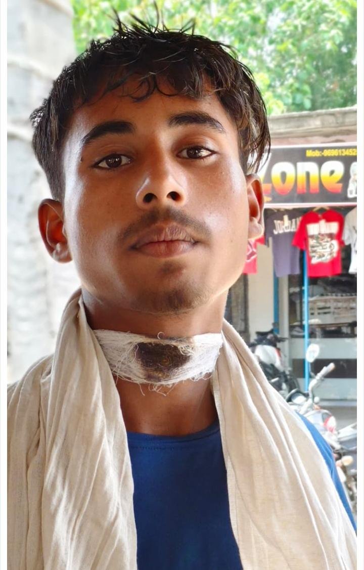 पकौड़ी खिलाने से इंकार पर सैलून में खूनी बवाल, गले पर छुरे के वार से युवक घायल