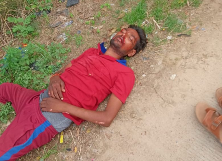 अज्ञात कार की ठोकर से बाइक सवार घायल, पत्नी और बच्चा बाल-बाल बचे